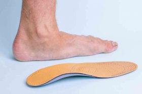 The left leg of an adult male with signs of foot disease next to the orthopedic insole. Means for the treatment of flat feet. Photos of diseases of the feet.