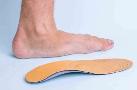 The left leg of an adult male with signs of foot disease next to the orthopedic insole. Means for the treatment of flat feet. Photos of diseases of the feet.