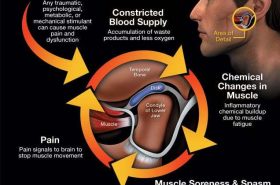 TMP Physiotherapy TMP Physiotherapy